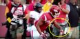 College footballer handles horrific arm break in remarkably calm manner [GRAPHIC]