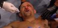 Chuck Liddell dead serious about taking arguably the most inadvisable fight imaginable